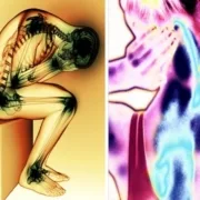 Fibromialgia